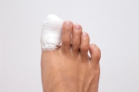 What Are Common Symptoms of a Broken Toe?