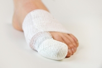 Causes of Broken Toes