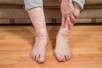 Red Feet in Elderly Individuals