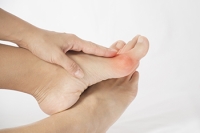 Causes, Definition, and Embracing Life While Living With a Bunion